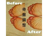 骨盤調整