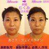 お客様ビフォーアフター！！！