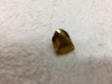 金歯お買い取り