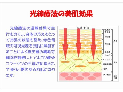 光線療法には美肌効果もあります！