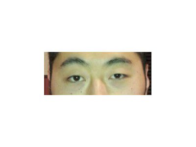 コスモアイビフォー