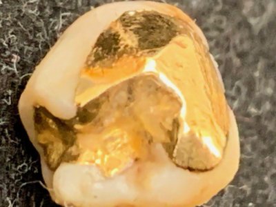 金歯 お買取りさせて頂きました 歯と一緒に「そのまま」お持ち下さい! 医療知識あります 金歯、歯科合金、銀歯の買取 「金町は大黒屋」です!