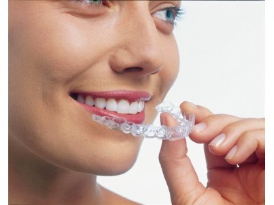 歯並びデジタル治療