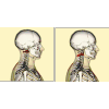 頭痛・首こり（肩こり）専門コースを特設している８つの理由