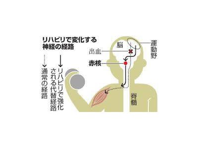 脳出血まひ、回復の「道」判明　リハビリ積むと代替神経