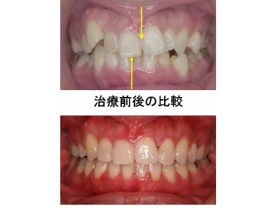 歯列矯正,インプラントCT検査