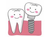 歯を守るためのインプラント治療　岐阜駅インプレ歯科