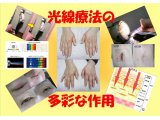 光線療法の多彩な作用