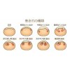 【巻き爪強化月間】痛いor痛くない！？巻き爪は色々なタイプがあります！