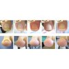 足のトラブル 「巻き爪」と「二枚爪」　原因と予防策は？