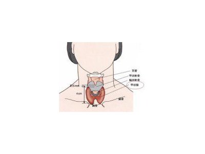 甲状腺機能亢進症