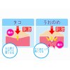 【魚の目】歩くときに痛みや違和感はありませんか？