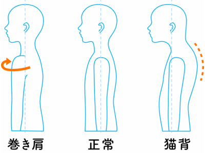 巻き肩を攻略