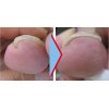 夏直前！足元のお手入れは進んでいますか？
