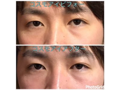 眼精疲労に◎世界初ソレンセン式コスモアイ☆