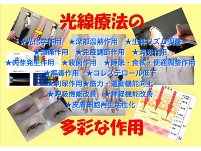 光線療法をご存知ない方へ