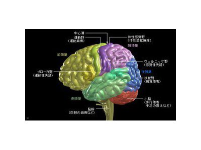 統合失調症、左脳に特徴＝深部の一部大きく
