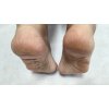 気になるかかかとの角質ケアは今が始め時！