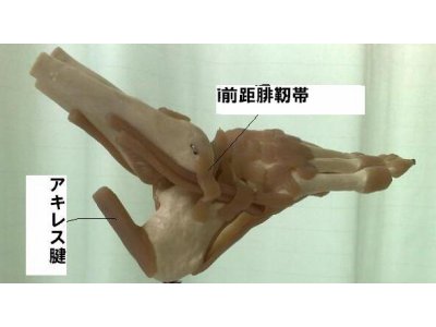足首捻挫の治し方 わさ接骨院 成増 バージョン