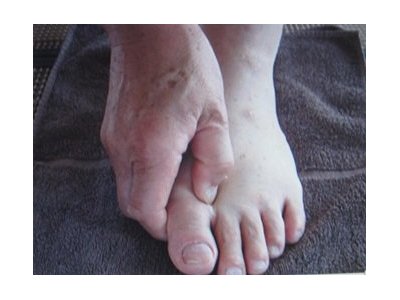 足もんで元気に(その2) ふれんど掲載コラム