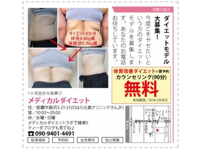 ダイエット広告