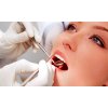 歯周病の治療＆予防　