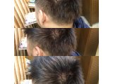 シルバーアッシュ